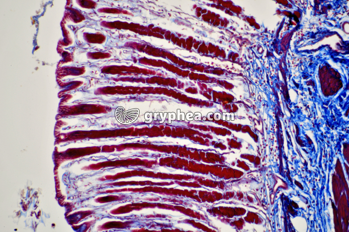 Estomac cardiaque x40 - gryphea.org